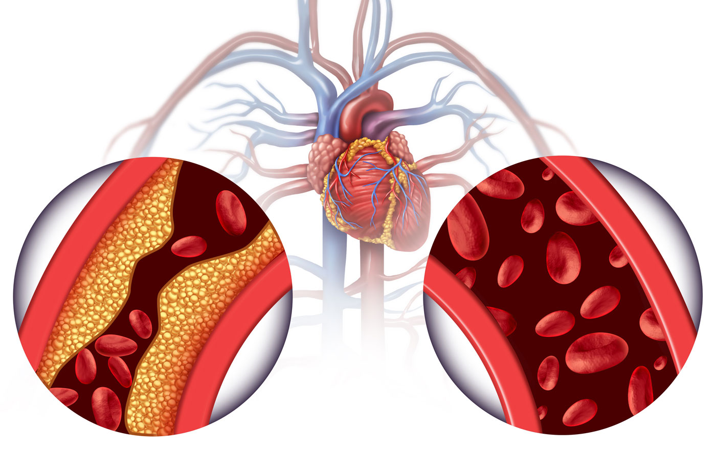 Olive oil and cholesterol the missing link