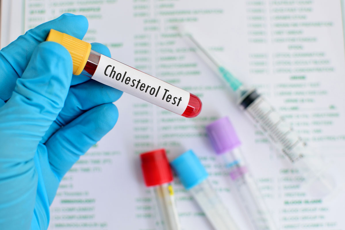 Blood tests about cholesterol