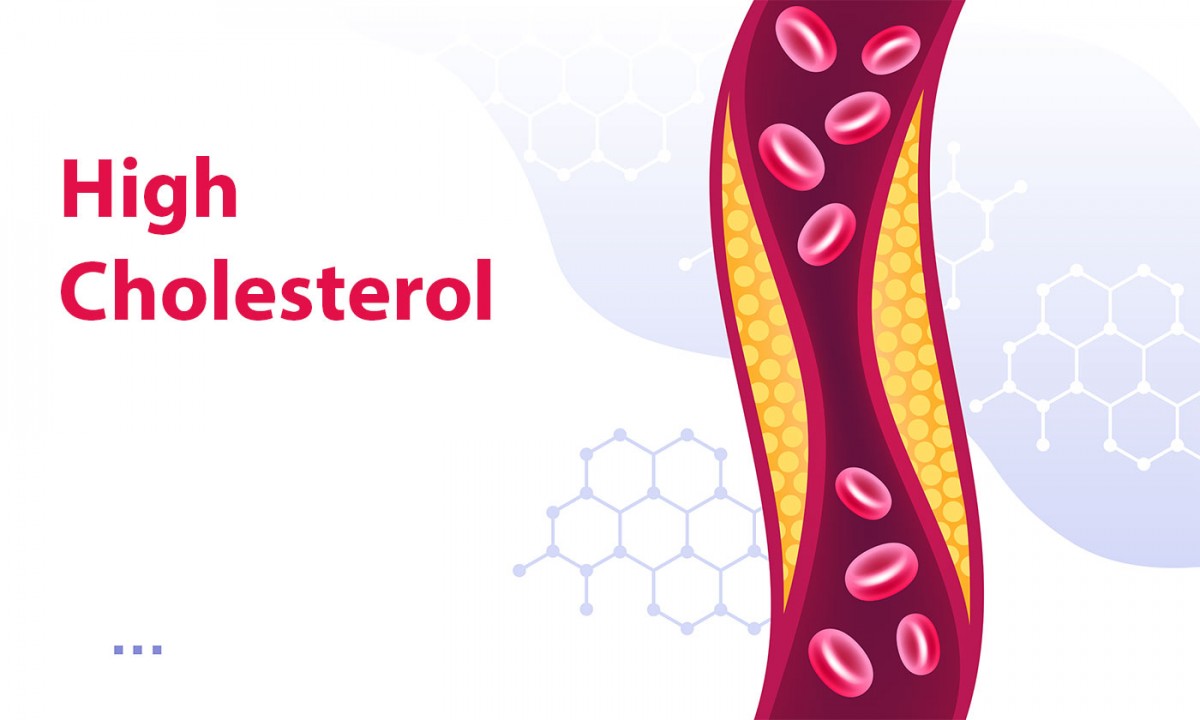 High Cholesterol and its Symptoms, Causes and Treatments, image size:1200x720