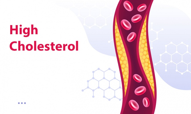 High Cholesterol and its Symptoms, Causes and Treatments
