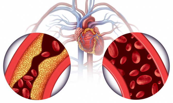 Olive Oil and Cholesterol - The Missing Link